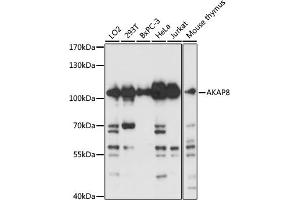 Western blot analysis of extracts of various cell lines, using  antibody (ABIN3017254, ABIN3017255, ABIN3017256 and ABIN6220015) at 1:3000 dilution. (AKAP8 antibody  (AA 480-692))