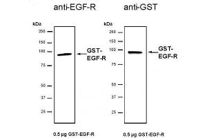 Western Blotting (WB) image for Epidermal Growth Factor Receptor (EGFR) (AA 672-1210), (GST-His-Tag) (Active) protein (GST-His-Tag) (ABIN2669457)