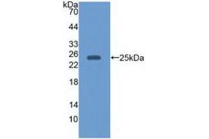 Detection of Recombinant EBI3, Human using Monoclonal Antibody to Epstein Barr Virus Induced Protein 3 (EBI3) (EBI3 antibody  (AA 21-229))