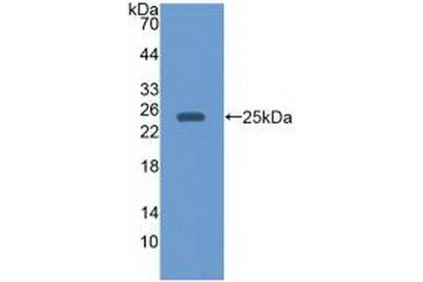 EBI3 anticorps  (AA 21-229)