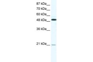 Western Blotting (WB) image for anti-Tumor Necrosis Factor Receptor Superfamily, Member 11b (TNFRSF11B) antibody (ABIN2463647) (Osteoprotegerin antibody)