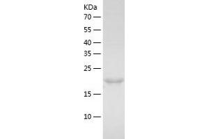 Western Blotting (WB) image for MAD2 Mitotic Arrest Deficient-Like 1 (Yeast) (MAD2L1) (AA 1-205) protein (His tag) (ABIN7123825) (MAD2L1 Protein (AA 1-205) (His tag))