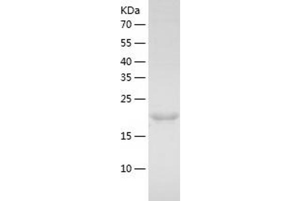 MAD2L1 Protein (AA 1-205) (His tag)