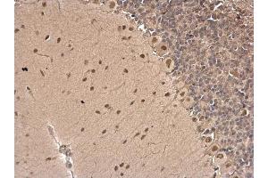 IHC-P Image CSB antibody [N2C1], Internal detects CSB protein at nucleus on rat hind brain by immunohistochemical analysis. (ERCC6 antibody  (Internal Region))