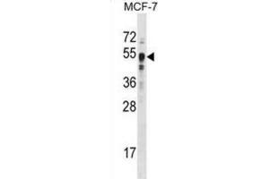 Western Blotting (WB) image for anti-SET Domain Containing 8 Pseudogene 1 (SETD8P1) antibody (ABIN2996451) (SET7 antibody)