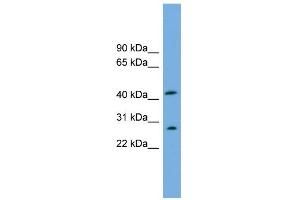WB Suggested Anti-RABEPK Antibody Titration: 0.