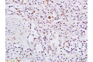 Immunohistochemistry (IHC) image for anti-Heat Shock Protein 90kDa alpha (Cytosolic), Class A Member 2 (HSP90AA2) (pThr5), (pThr7) antibody (ABIN685333)