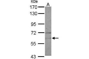 WB Image Sample (30 ug of whole cell lysate) A: U87-MG 7. (NARS antibody)