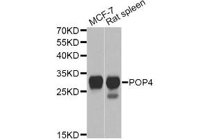 Western blot analysis of extracts of various cell lines, using POP4 Antibody.