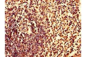 Immunohistochemistry of paraffin-embedded human spleen tissue using ABIN7156631 at dilution of 1:100 (IRF7 antibody  (AA 131-289))