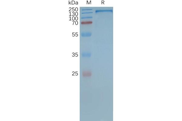 Malic Enzyme Complex, Mitochondrial (Mod2) Protein