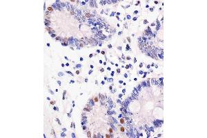 (ABIN6243211 and ABIN6577174) staining GDH in human colon tissue sections by Immunohistochemistry (IHC-P - paraformaldehyde-fixed, paraffin-embedded sections). (GAPDH antibody  (AA 43-335))