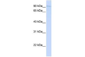 WB Suggested Anti-SYDE1 Antibody Titration:  0. (SYDE1 antibody  (N-Term))