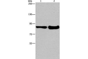 Western Blot analysis of Mouse lung and liver tissue using MAPRE3 Polyclonal Antibody at dilution of 1:1050