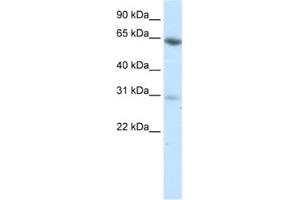 Western Blotting (WB) image for anti-Zinc Finger Protein 195 (ZNF195) antibody (ABIN2461814)
