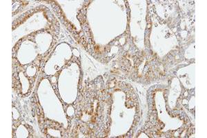 IHC-P Image Immunohistochemical analysis of paraffin-embedded H441 xenograft, using COX5B, antibody at 1:100 dilution. (COX5B antibody  (Center))
