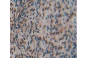 Figure. (LYAR antibody  (AA 271-386))