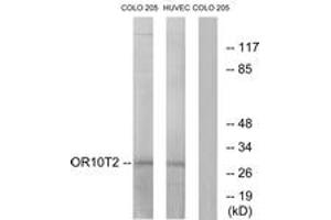 Western blot analysis of extracts from HuvEc/COLO cells, using OR10T2 Antibody. (OR10T2 antibody  (AA 231-280))