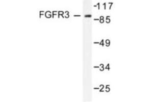 Image no. 1 for anti-Fibroblast Growth Factor Receptor 3 (FGFR3) antibody (ABIN265418) (FGFR3 antibody)