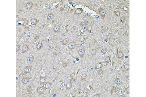 Immunohistochemistry of paraffin-embedded Mouse brain using EIF3C Polyclonal Antibody at dilution of 1:100 (40x lens). (EIF3C antibody)