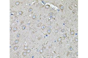 Immunohistochemistry of paraffin-embedded Mouse brain using EIF3C Polyclonal Antibody at dilution of 1:100 (40x lens).