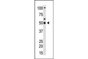 Image no. 1 for anti-YY1 Transcription Factor (YY1) (N-Term) antibody (ABIN357756) (YY1 antibody  (N-Term))