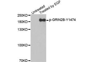 Western blot analysis of extracts from A431 cells, using Phospho-GRIN2B-Y1474 antibody.