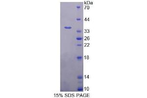 Image no. 1 for PSME3 (PSME3) (AA 7-254) protein (His tag) (ABIN4990524)