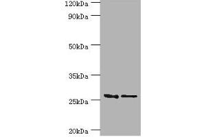 Western blot All lanes: GSTM4 antibody at 10 μg/mL Lane 1: Rat lung tissue Lane 2: MCF-7 whole cell lysate Secondary Goat polyclonal to rabbit IgG at 1/10000 dilution Predicted band size: 26, 23, 19 kDa Observed band size: 26 kDa (GSTM4 antibody  (AA 1-218))