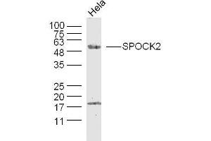 Human Hela cells probed with SPOCK2/Testican 2 Polyclonal Antibody, unconjugated  at 1:300 overnight at 4°C followed by a conjugated secondary antibody at 1:10000 for 90 minutes at 37°C. (SPOCK2/Testican 2 antibody  (AA 61-160))