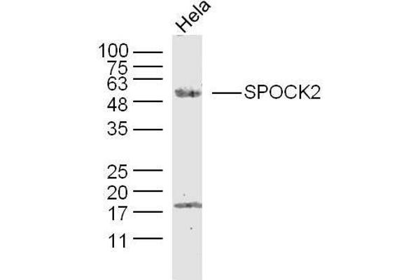 SPOCK2/Testican 2 Antikörper  (AA 61-160)