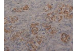 Immunohistochemistry (IHC) image for anti-Keratin 18 (KRT18) (AA 238-396) antibody (ABIN7433288)