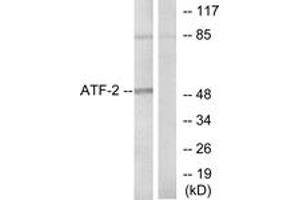 Western blot analysis of extracts from HeLa cells, using ATF2 (Ab-71 or 53) Antibody. (ATF2 antibody  (AA 38-87))