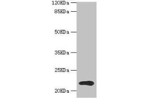 TPD52L1 抗体  (AA 1-144)