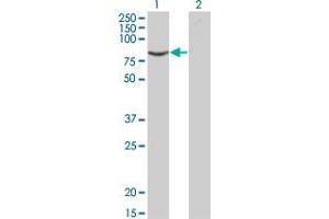 Western Blot analysis of ACVR2B expression in transfected 293T cell line by ACVR2B monoclonal antibody (M03), clone 1C11. (ACVR2B antibody  (AA 21-120))