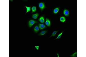 Immunofluorescence staining of A549 cells with ABIN7161627 at 1:166, counter-stained with DAPI. (NOS2 antibody  (AA 17-141))