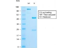 SDS-PAGE Analysis of Purified Insulin Rabbit Recombinant Monoclonal Antibody (IRDN/1980R). (Recombinant Insulin antibody)