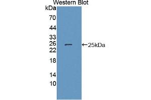 Detection of Recombinant HSPb7, Human using Polyclonal Antibody to Heat Shock Protein Beta 7 (HSPb7)