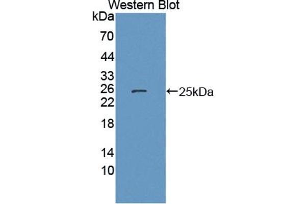 HSPB7 antibody  (AA 1-170)