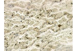 ABIN6258720 and ABIN6274746 at 1/100 staining human normal lung tissue by IHC-P.