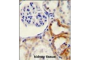 HYAL2 Antibody (C-term) (ABIN654687 and ABIN2844379) immunohistochemistry analysis in formalin fixed and paraffin embedded human kidney tissue followed by peroxidase conjugation of the secondary antibody and DAB staining. (HYAL2 antibody  (C-Term))