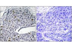 Immunohistochemistry (IHC) image for anti-Interferon Regulatory Factor 3 (IRF3) (AA 351-400) antibody (ABIN1532350)
