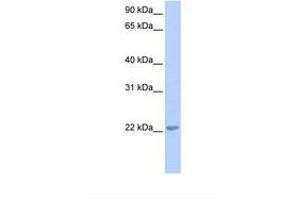 Image no. 1 for anti-Transcription Elongation Factor A (SII)-Like 2 (TCEAL2) (N-Term) antibody (ABIN6739300) (TCEAL2 antibody  (N-Term))