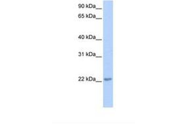 TCEAL2 antibody  (N-Term)