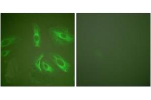 Immunofluorescence analysis of HeLa cells, using Gastrin Antibody. (Gastrin antibody  (AA 52-101))