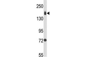 Western blot analysis of Integrin alpha 2 antibody and MDA-MB231 lysate (ITGA2 antibody  (AA 1023-1049))