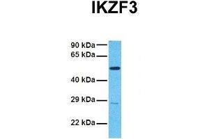 Host:  Rabbit  Target Name:  IKZF3  Sample Tissue:  Human 786-0  Antibody Dilution:  1. (IKZF3 antibody  (N-Term))