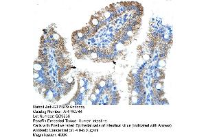 Rabbit Anti-GTPBP9 Antibody  Paraffin Embedded Tissue: Human Intestine Cellular Data: Epithelial cells of intestinal villas Antibody Concentration: 4. (OLA1 antibody  (N-Term))