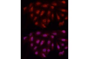 Immunofluorescence analysis of U2OS cells using WTAP Rabbit pAb (ABIN7271372) at dilution of 1:50 (40x lens). (WTAP antibody  (AA 1-396))