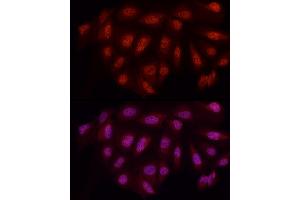 Immunofluorescence analysis of U2OS cells using WTAP Rabbit pAb (ABIN7271372) at dilution of 1:50 (40x lens). (WTAP antibody  (AA 1-396))